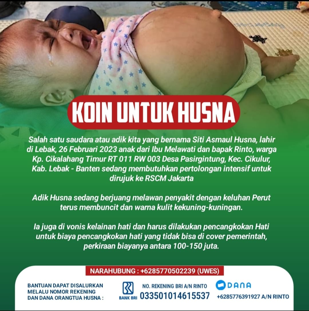 Siti Asmaul Husna Bayi Yang  Menderita Penyakit  Choleslitiasis Jaundice